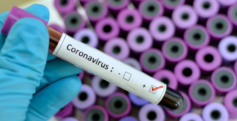 КОРОНАВІРУСНА ІНФЕКЦІЯ COVID-19