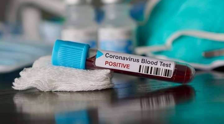 Алгоритм дій за підозри COVID-19 Алгоритм дій за підозри COVID-19